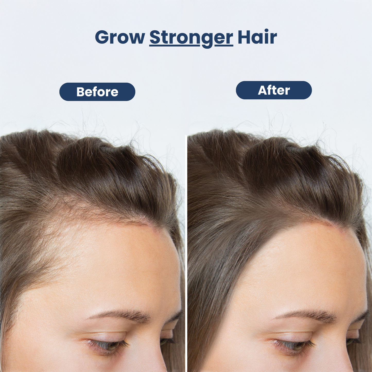 Viral Hair Growth Oil