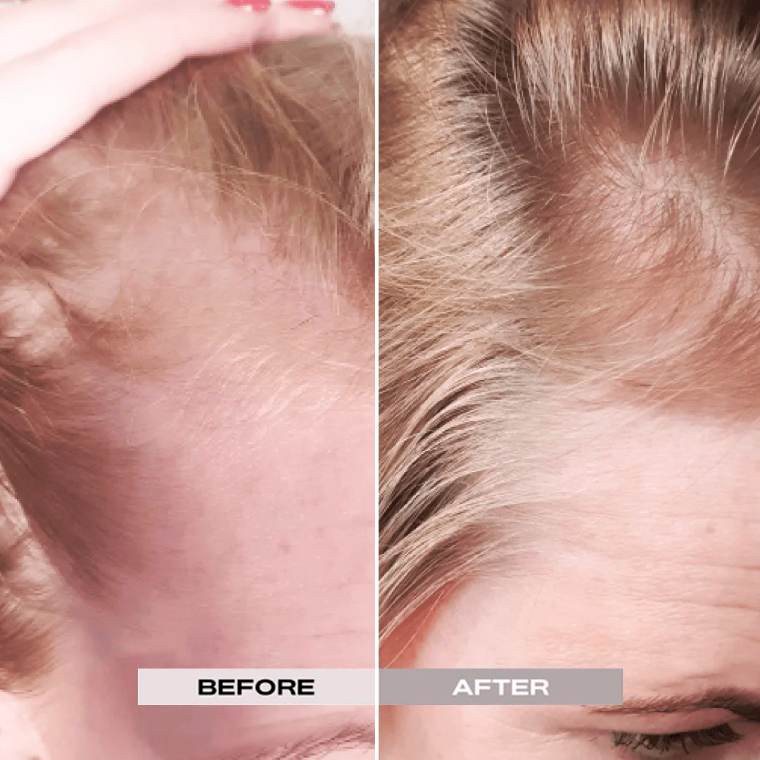 Careloom™ Signature Scalp & Hair Oil Micro-Delivery System