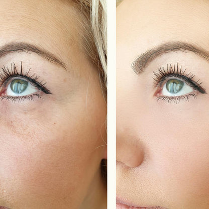 Botox Serum
